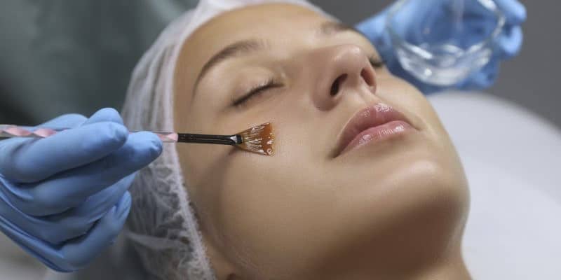 Chemical Peel Cost in India