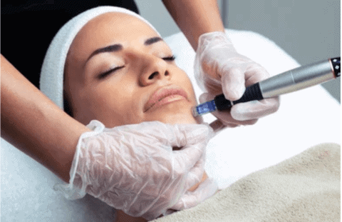 Micro-needling
