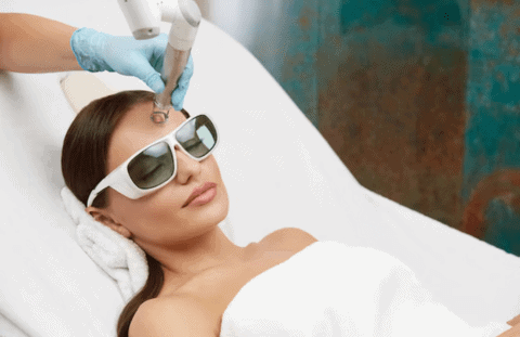 Q-Switch (Laser Facial)